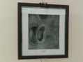 Ecografia de Mellizo