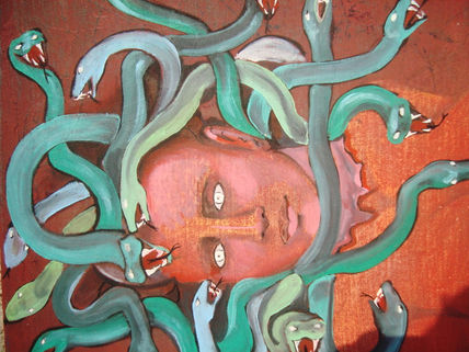 Migraña