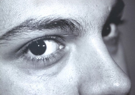 Ojos