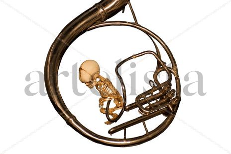 Cordon umbilical 2