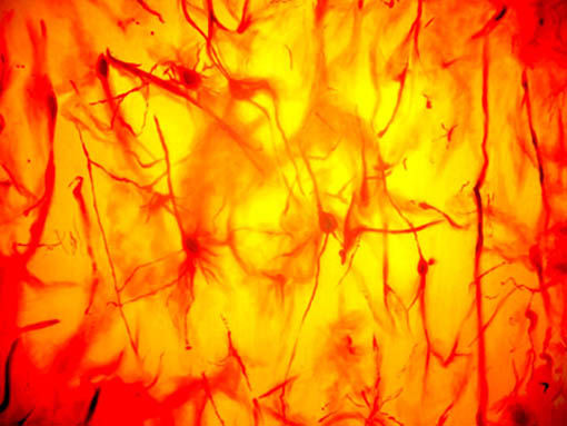 neuronas 2