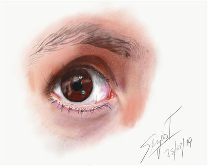 El ojo de mi esposa