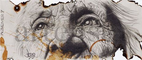 Alzheimer 7