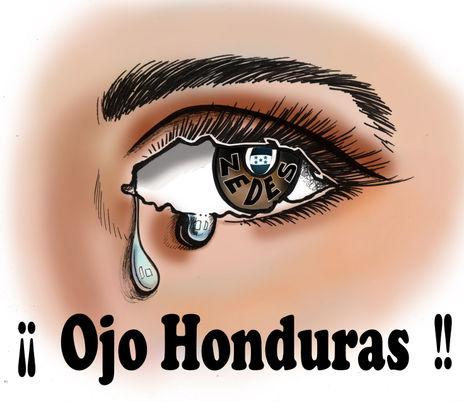 No a las zedes,...