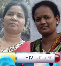 Hiv aids patient in...