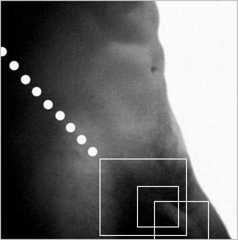 Homenaje a Mapplethorpe 1