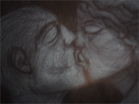 El beso
