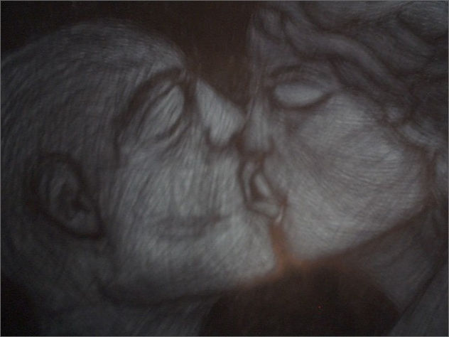 el beso