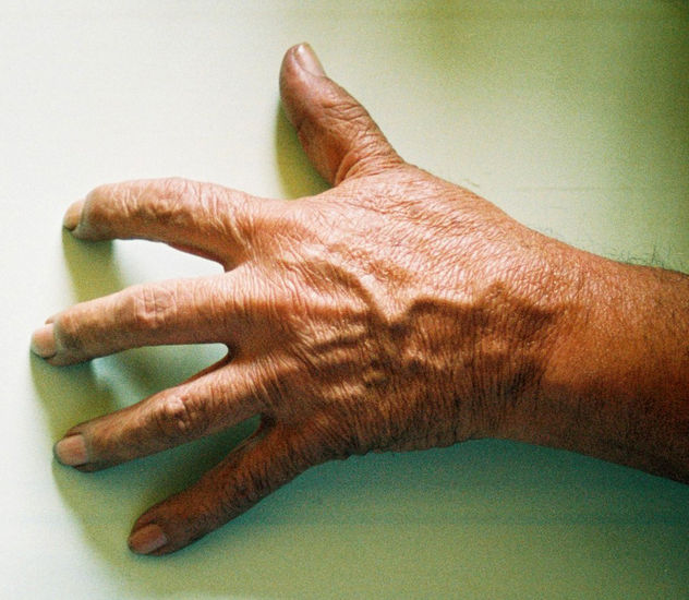 Mano