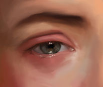 Ojo