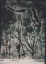 Histerectomia