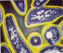 Legionella