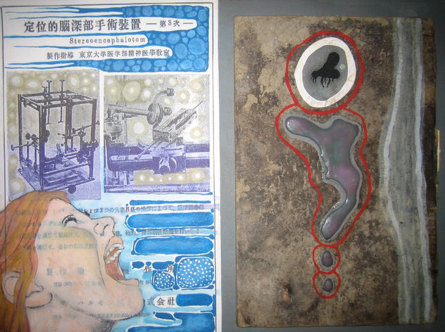Psiquiatrico Japones03.Stereoencephalotom