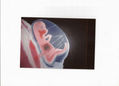 vida intrauterina