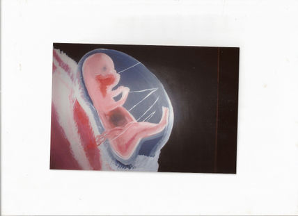 Vida intrauterina