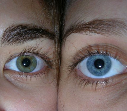 Ojos