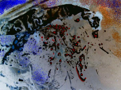 Disnea vision
