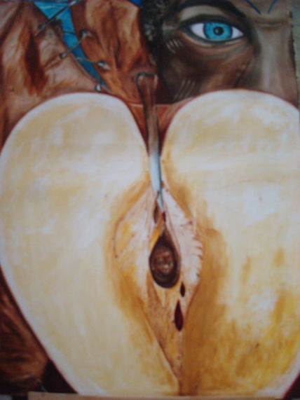 Ablacion ll