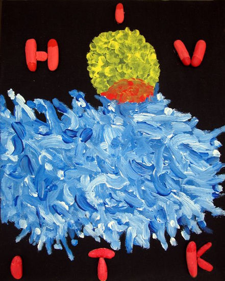 HIV-ITK Acrylic Canvas Others