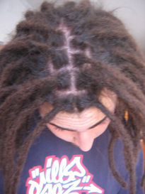 Rastas 1