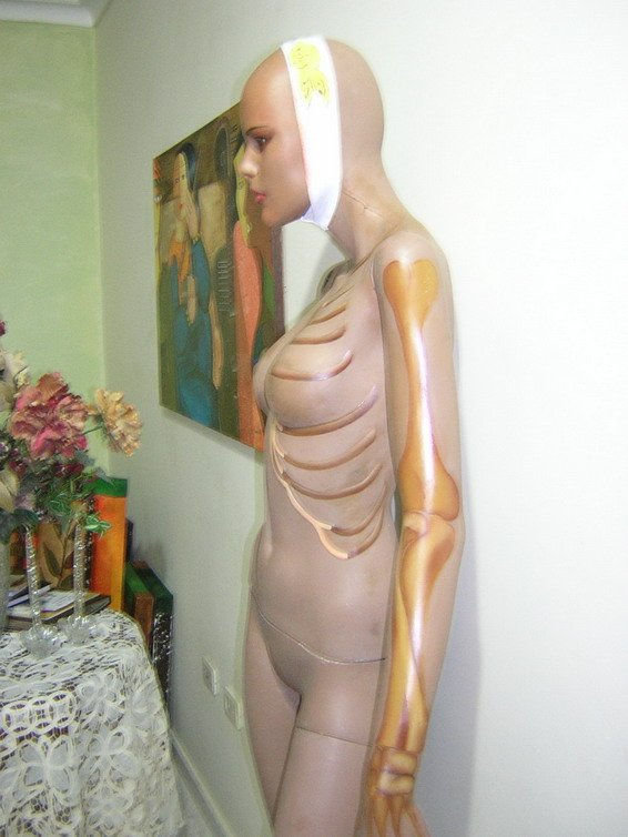ANOREXIA