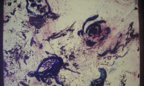 Triptico