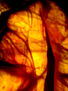 DERMIS II