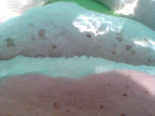 Anemona