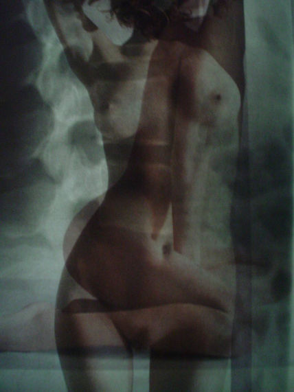 Interno externo