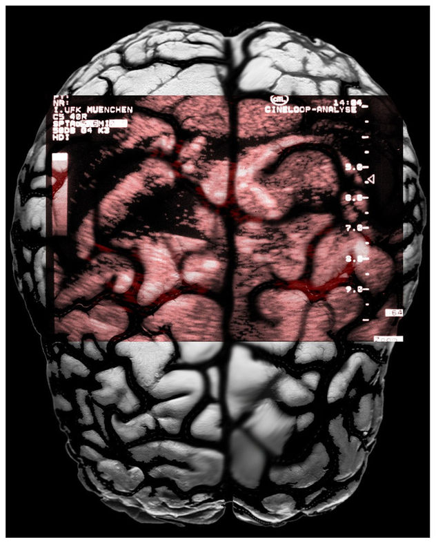 Babybrain