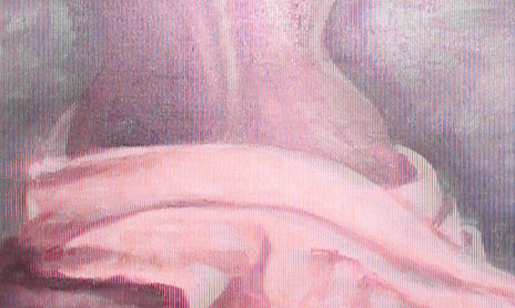 Figura Humana
