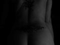 Skin lines