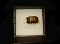 anillo6