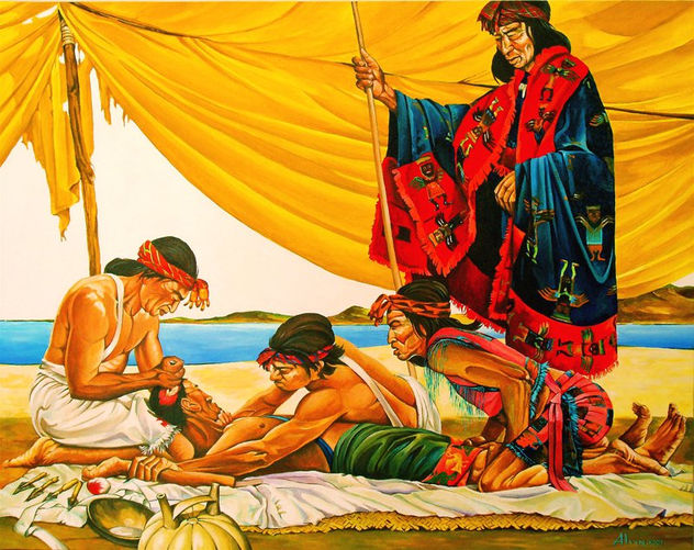 TREPANACION DE LOS INDIOS