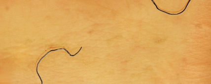 De la serie "PIEL"