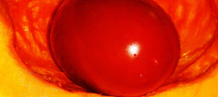 Tomate.