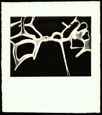 Trabéculas I