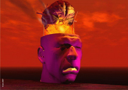 Cerebral