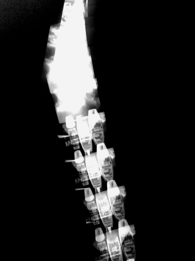 S/T
