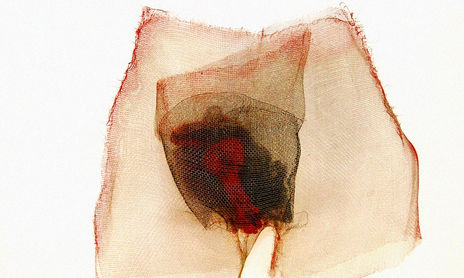 Uteros