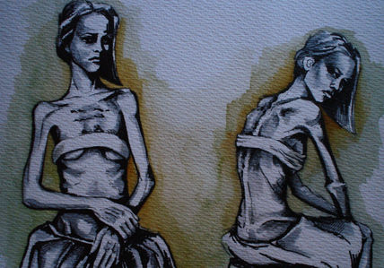 Anorexia