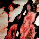 Hiv-Sida thumbnail 1