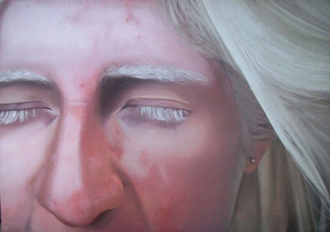 Albina