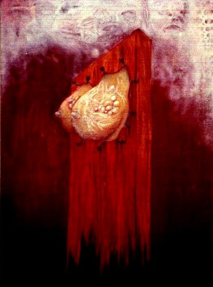 Metastasis