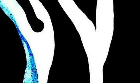 "TROSETS DE MI"