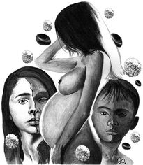 Anemia