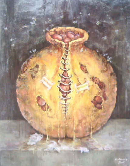 Contención