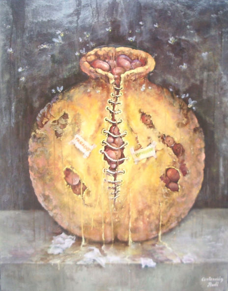 Contención