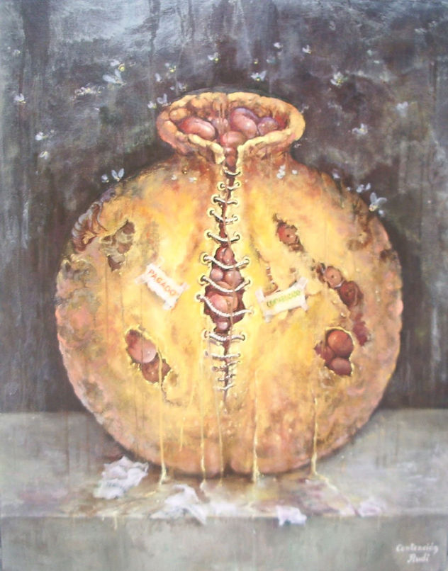 CONTENCIÓN