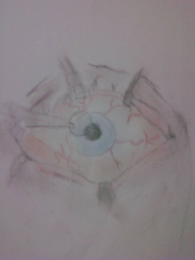 operacion ocular